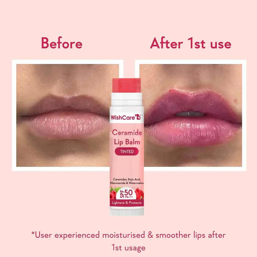 WishCare Tinted & Untinted Ceramide Lip Balm for Dark Lips with SPF 50 & Kojic Acid (5gm + 5gm),Assorted