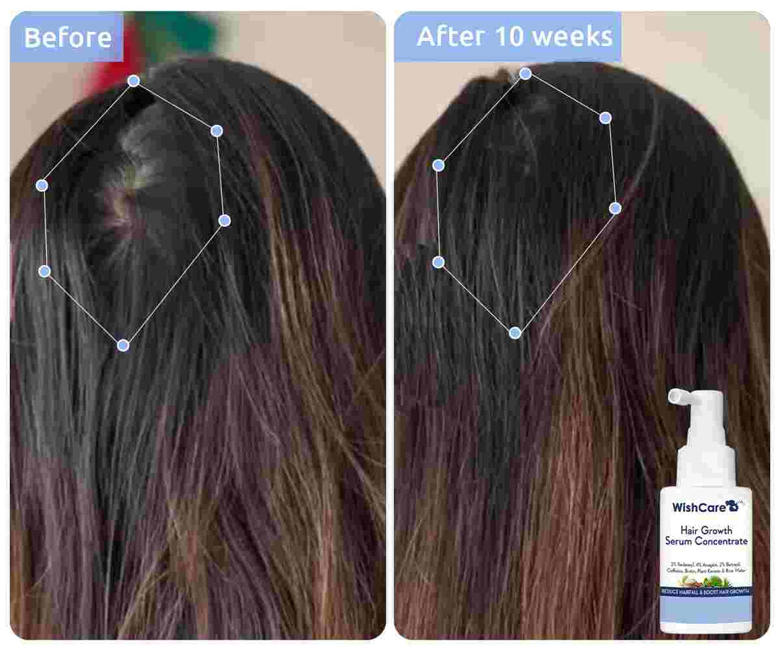 WishCare Hair Growth Serum Concentrate 30ml