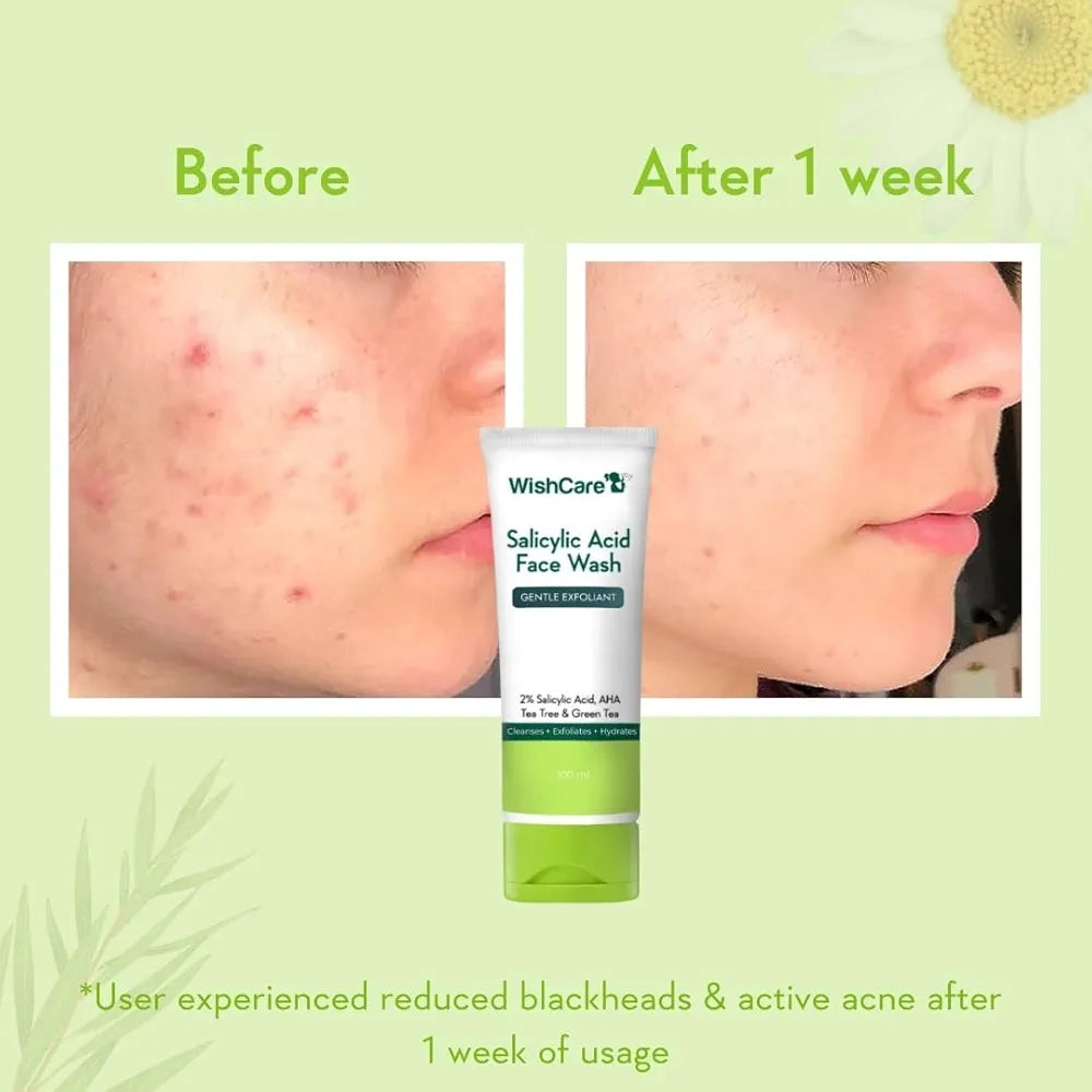 Wishcare Salicylic Acid Face Wash