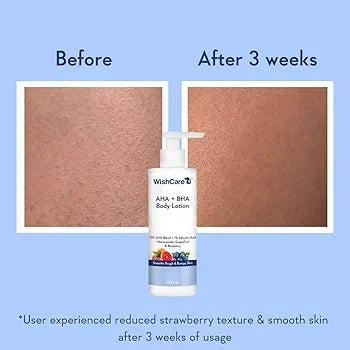 Wishcare AHA + BHA Body Lotion (200ml)