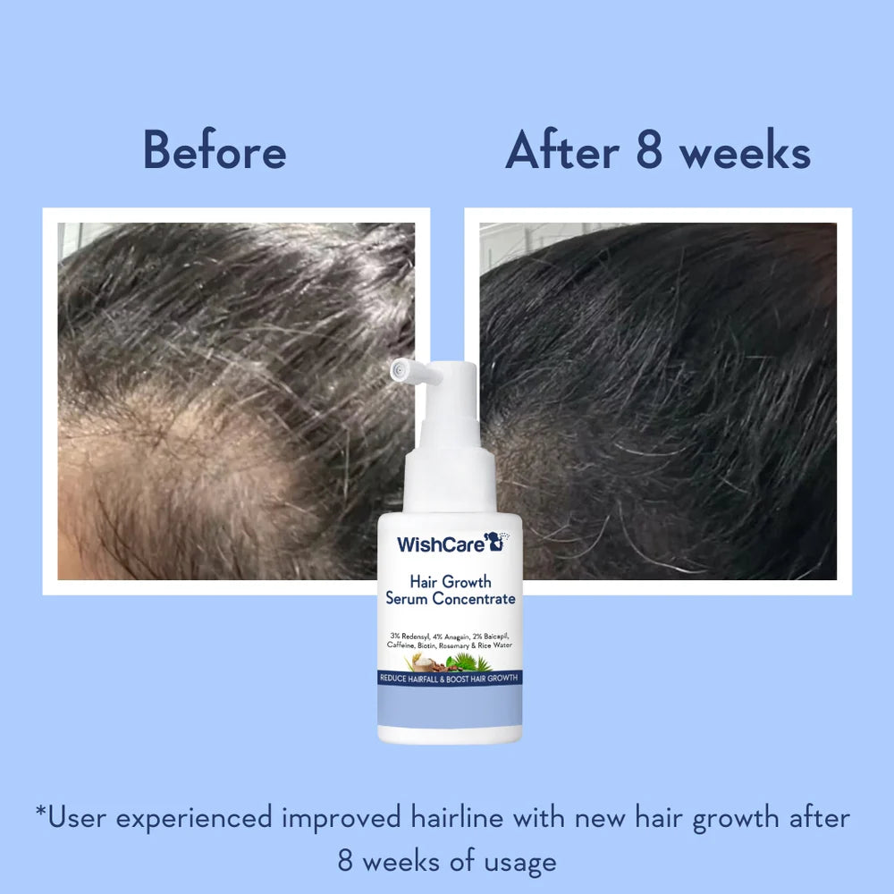 WishCare Hair Growth Serum Concentrate 30ml